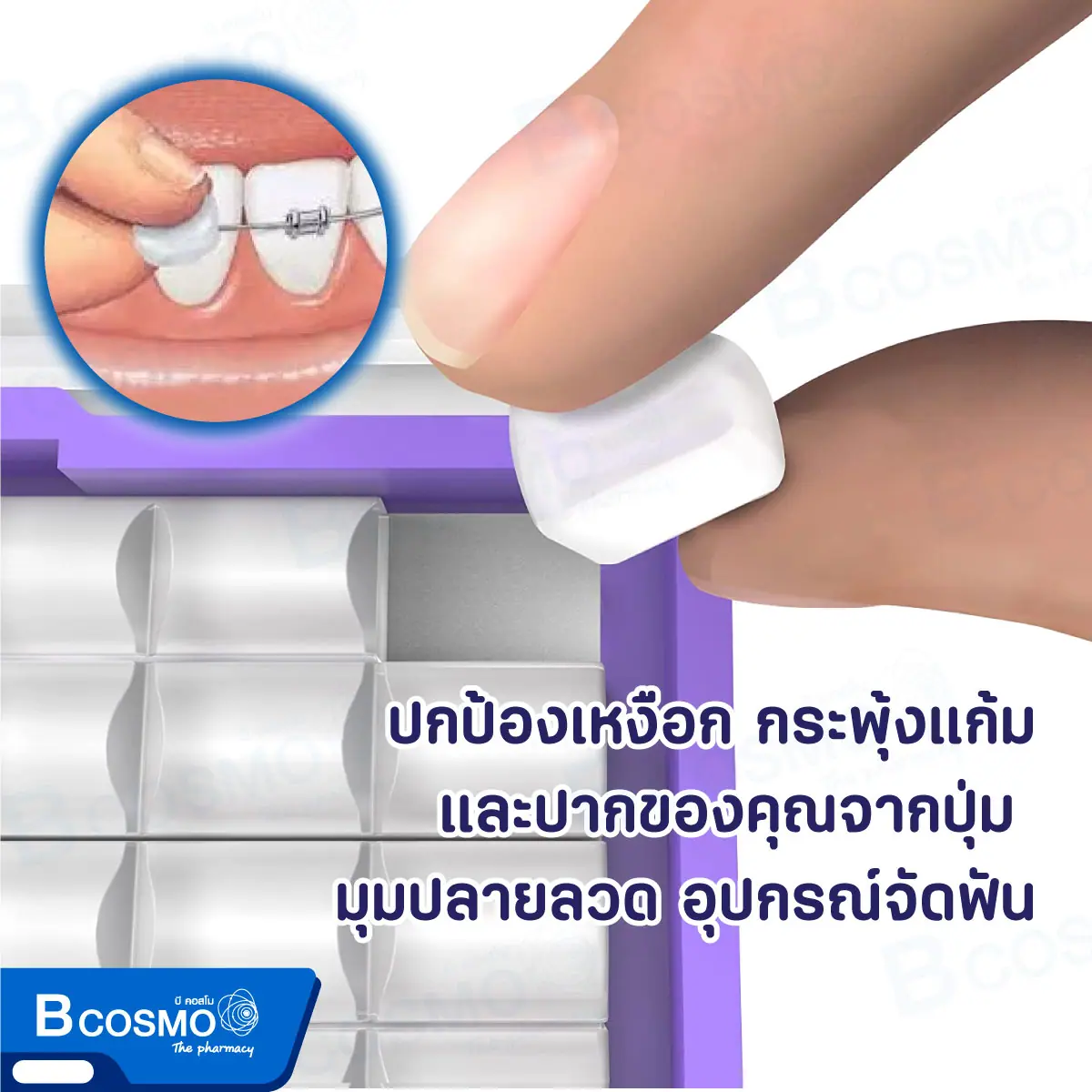 ขี้ผึ้งจัดฟัน G.U.M 724 Ortho Wax กลิ่น Mint ขี้ผึ้งจัดฟัน G.U.M 724 Ortho Wax กลิ่น Mint