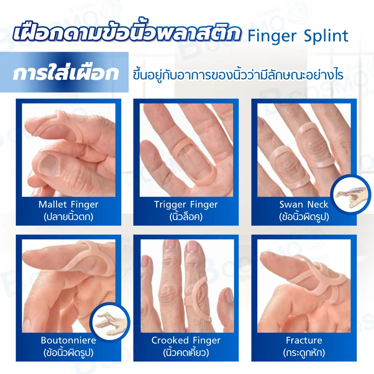 เฝือกดามข้อนิ้วพลาสติก Finger Splint เฝือกดามข้อนิ้วพลาสติก Finger Splint