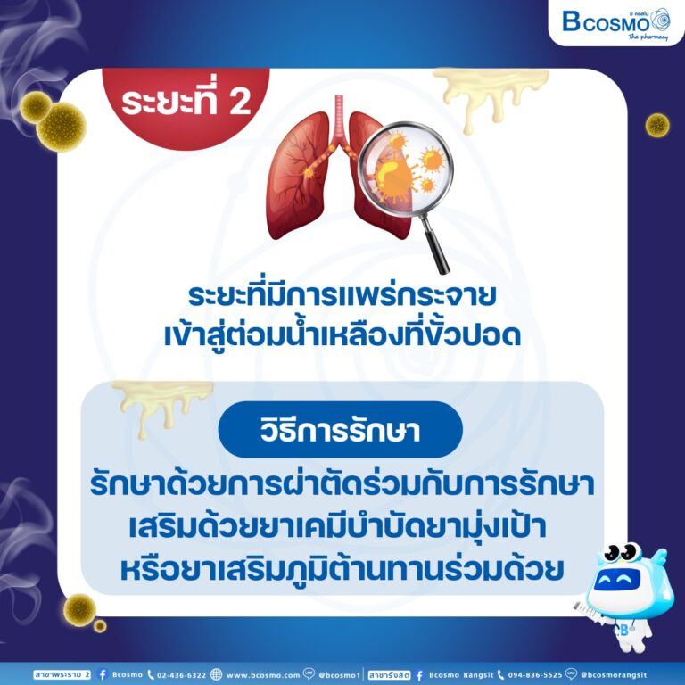 รู้ทัน สัญญาณมะเร็งปอด